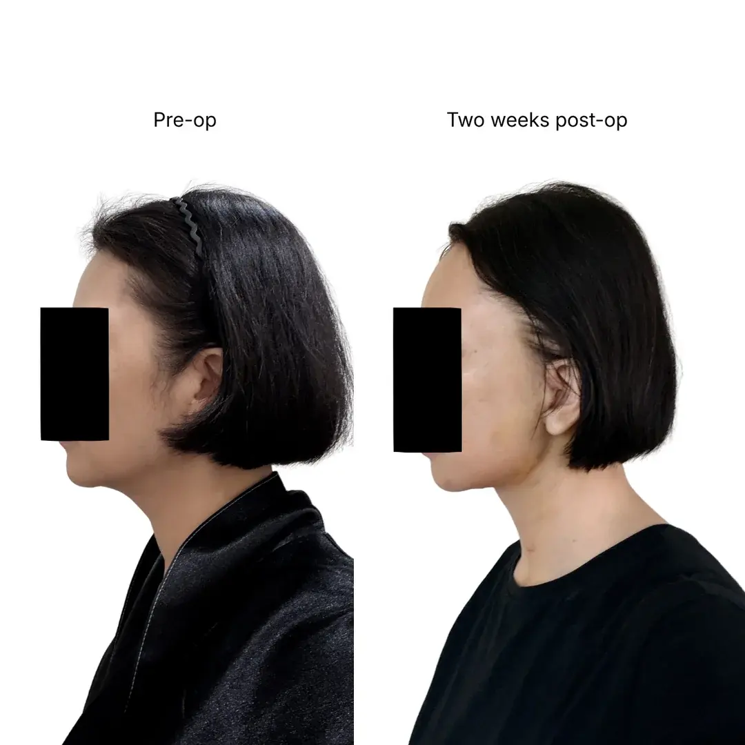 Dasipium Plastic Surgery — 2