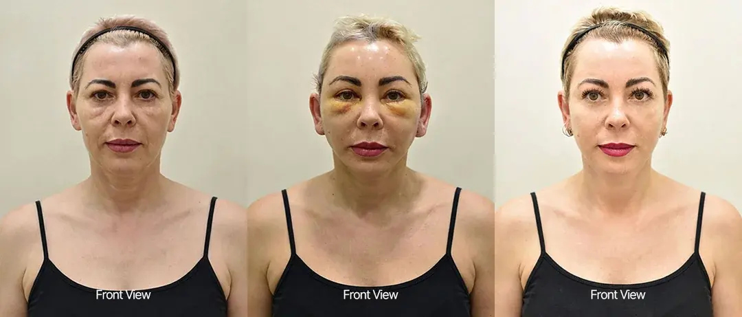 ILCHI Plastic Surgery — 1