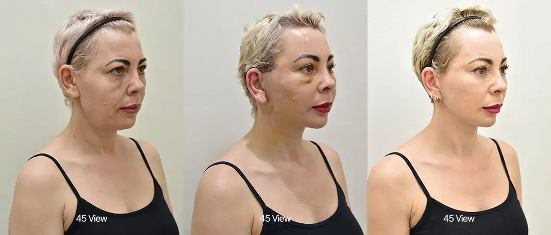 ILCHI Plastic Surgery — 2