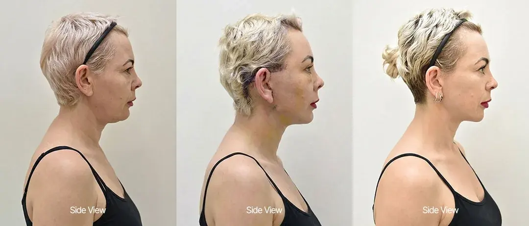 ILCHI Plastic Surgery — 3