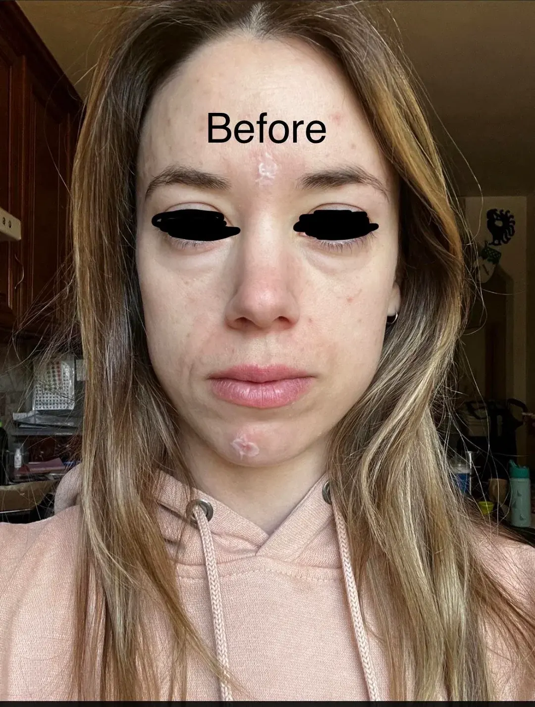 Woori Plastic Surgery Clinic — 2