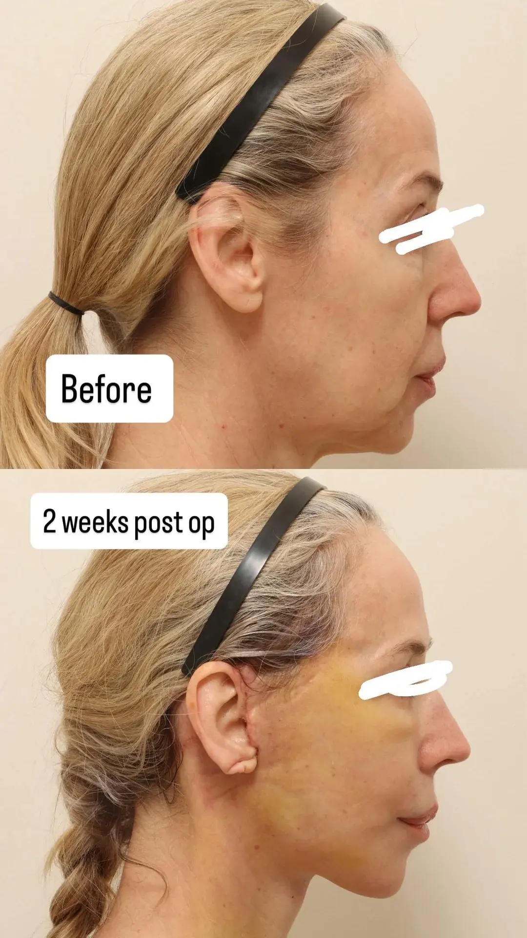 NOTE Plastic Surgery — 1