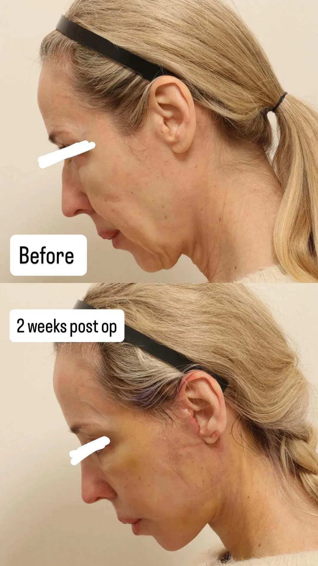 NOTE Plastic Surgery — 2