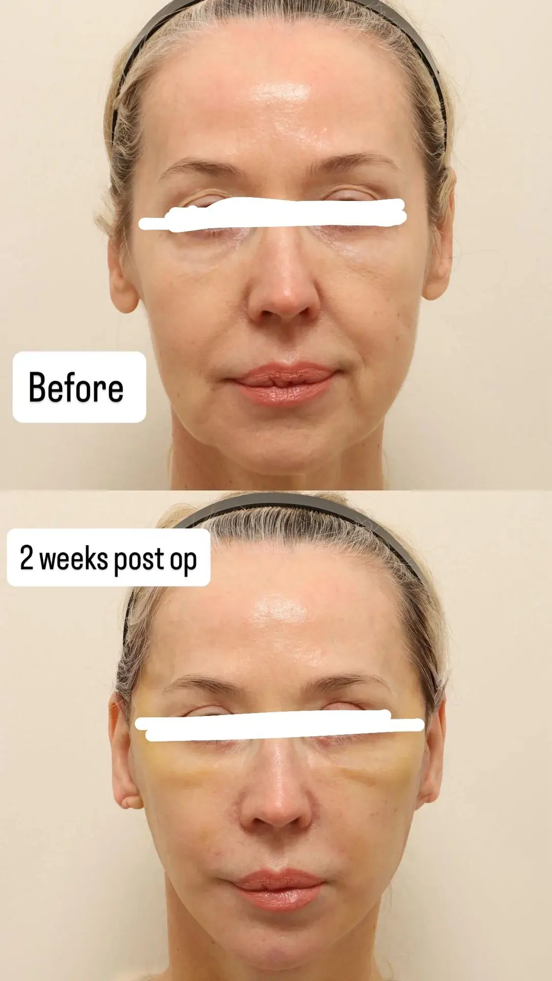 NOTE Plastic Surgery — 3