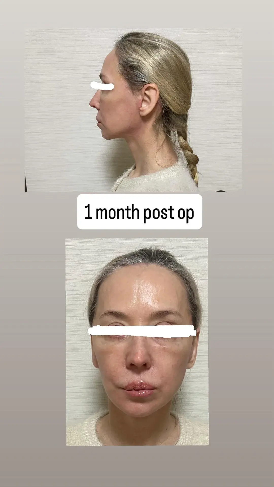 NOTE Plastic Surgery — 4