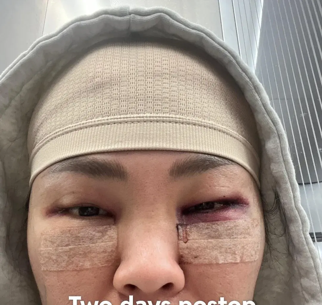 Woori Plastic Surgery Clinic — 2