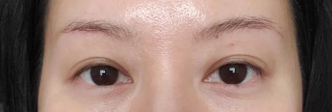 Marble Plastic Surgery — 2