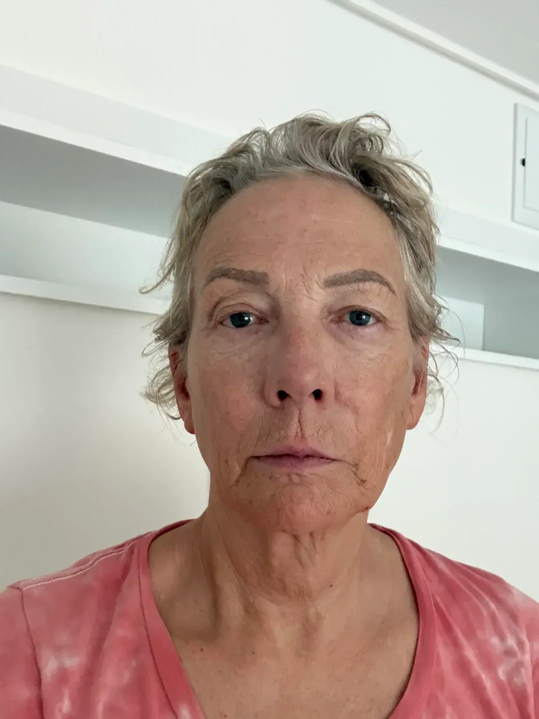 Dasipium Plastic Surgery — 1