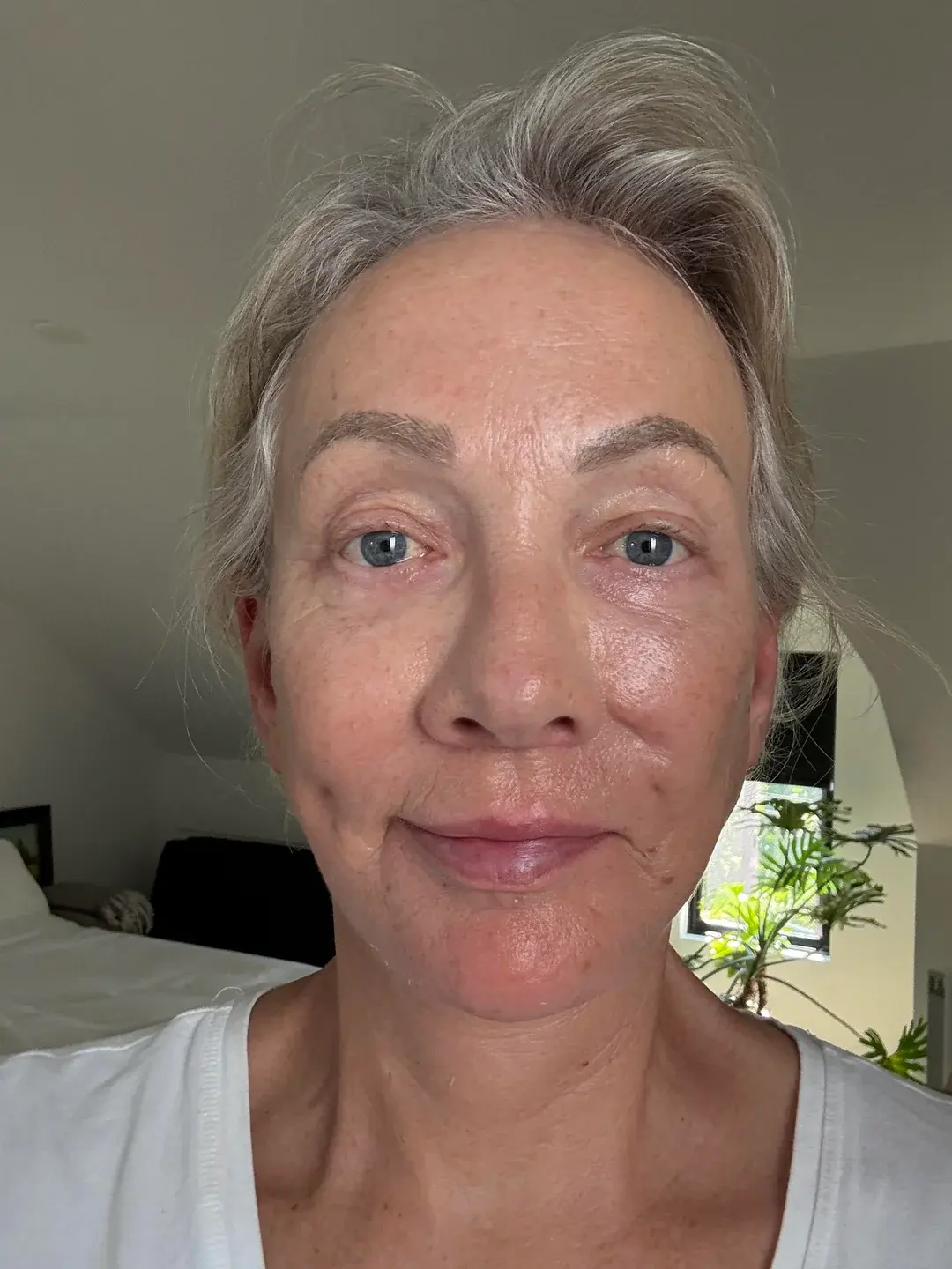 Dasipium Plastic Surgery — 3