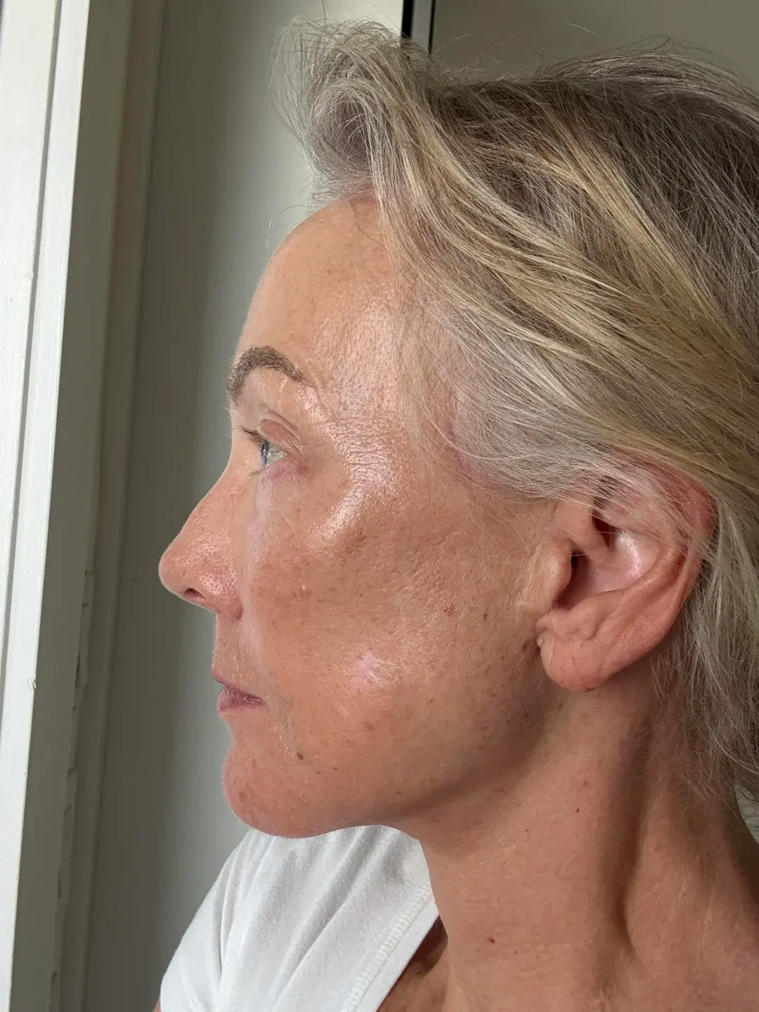 Dasipium Plastic Surgery — 4