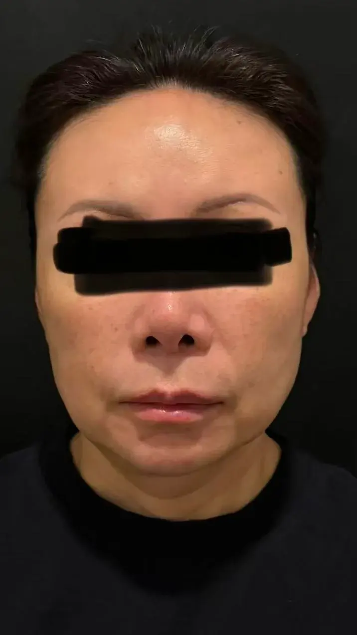 IKNOWU Plastic Surgery — 1