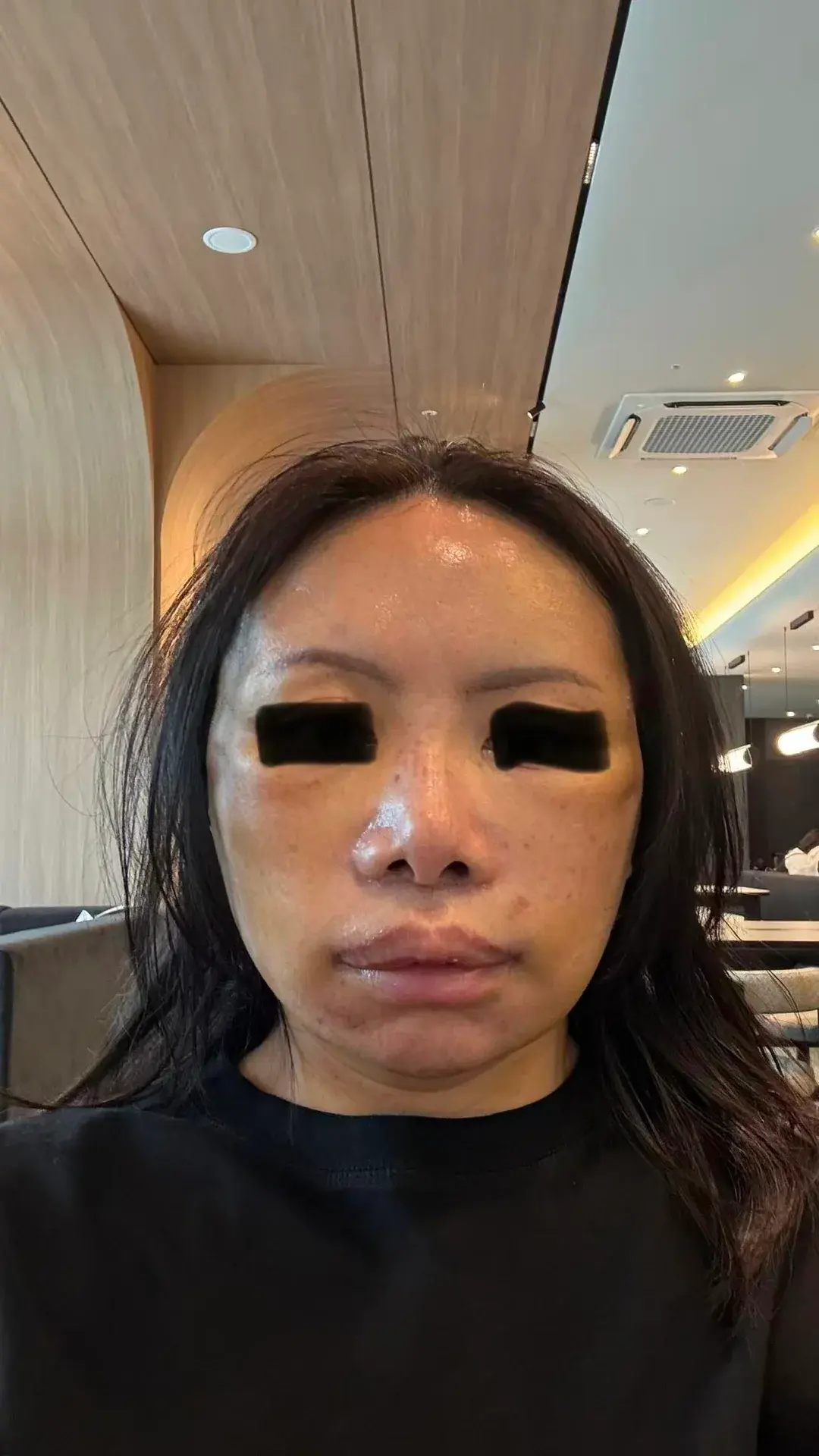 IKNOWU Plastic Surgery — 2