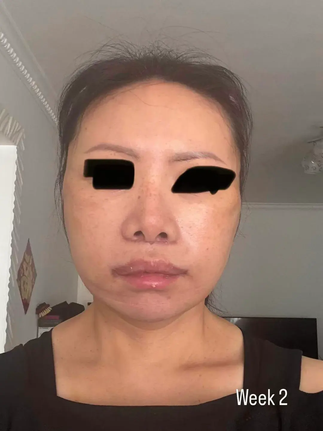 IKNOWU Plastic Surgery — 3