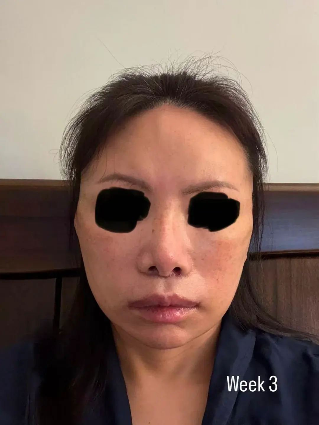 IKNOWU Plastic Surgery — 4