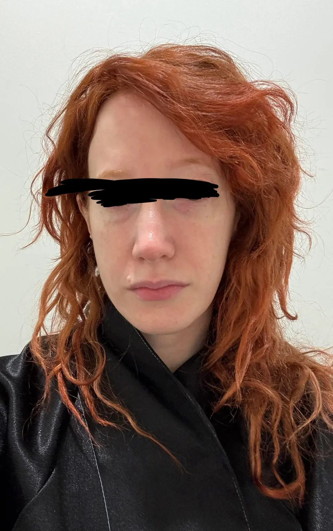 Dasipium Plastic Surgery — 1