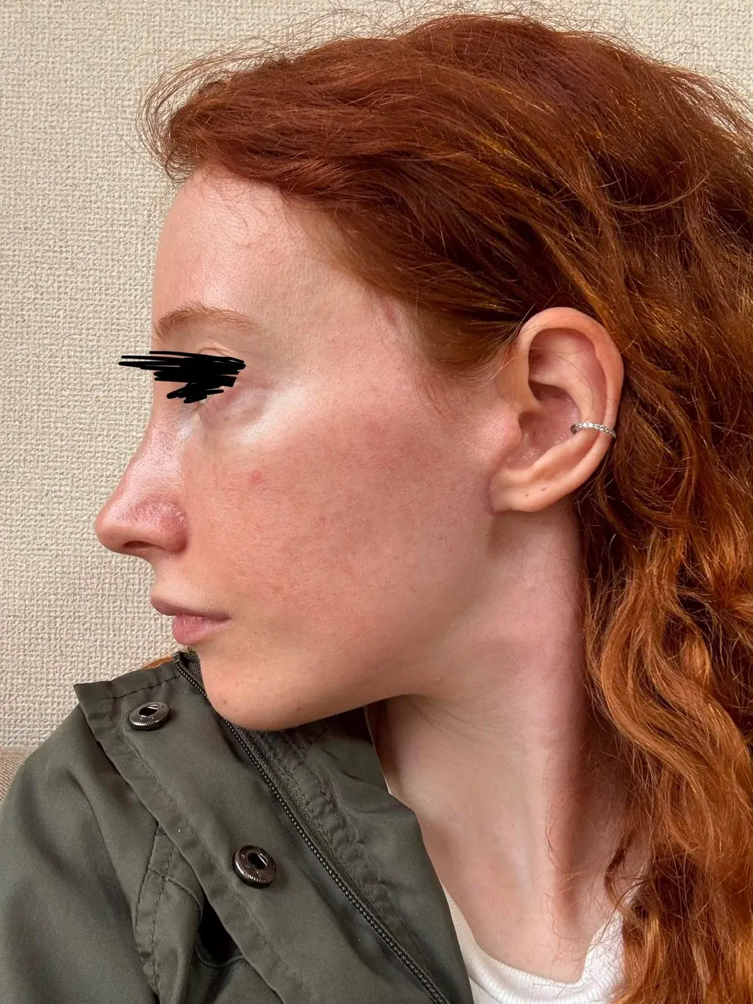 Dasipium Plastic Surgery — 2