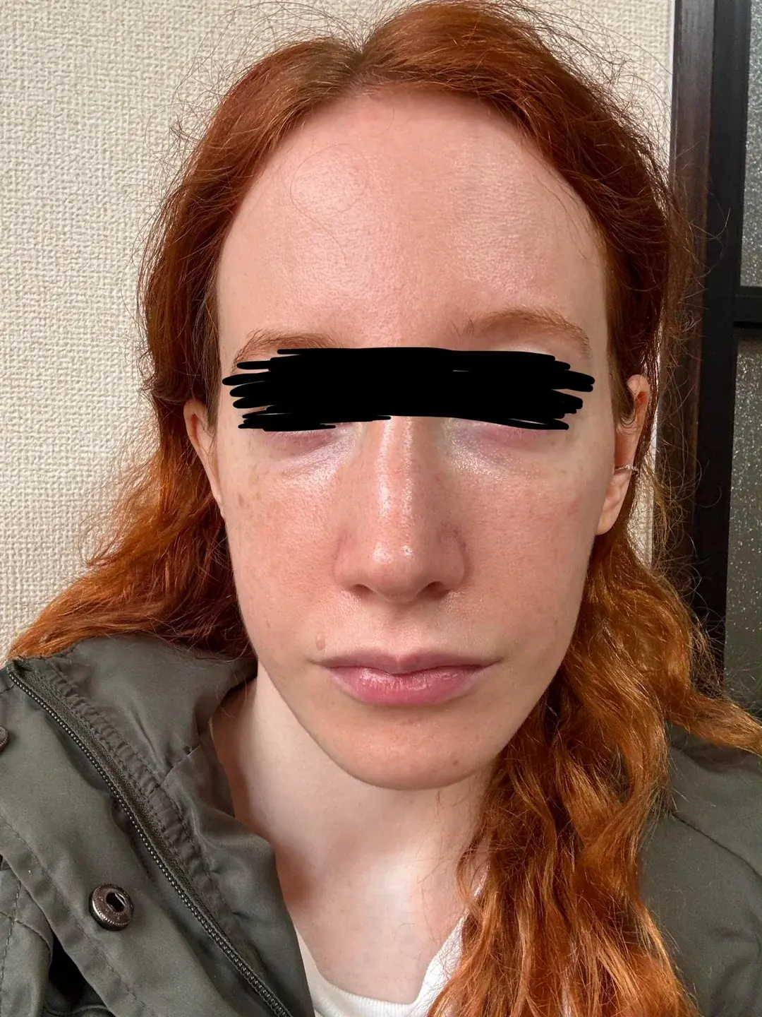Dasipium Plastic Surgery — 3