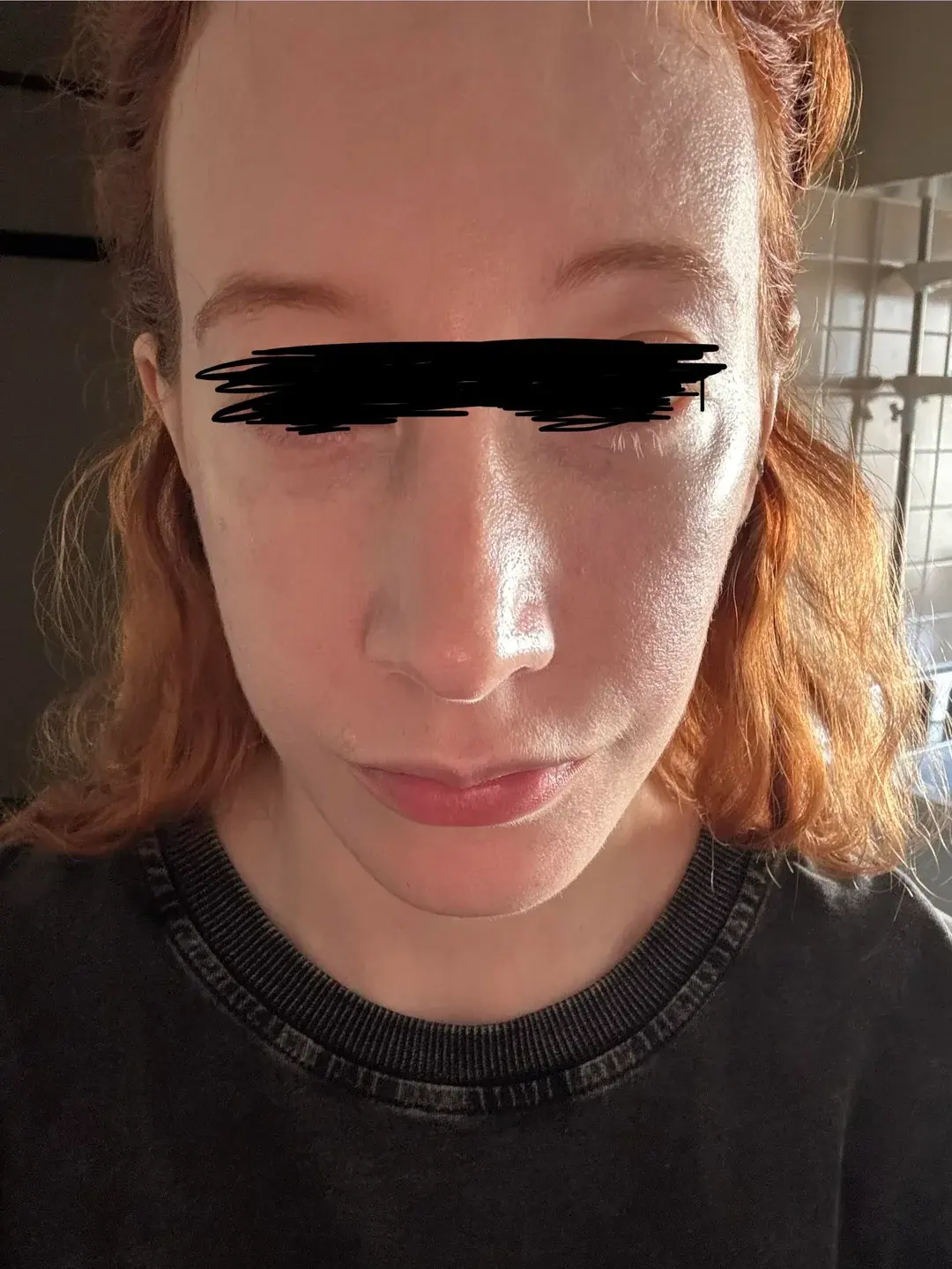 Dasipium Plastic Surgery — 4