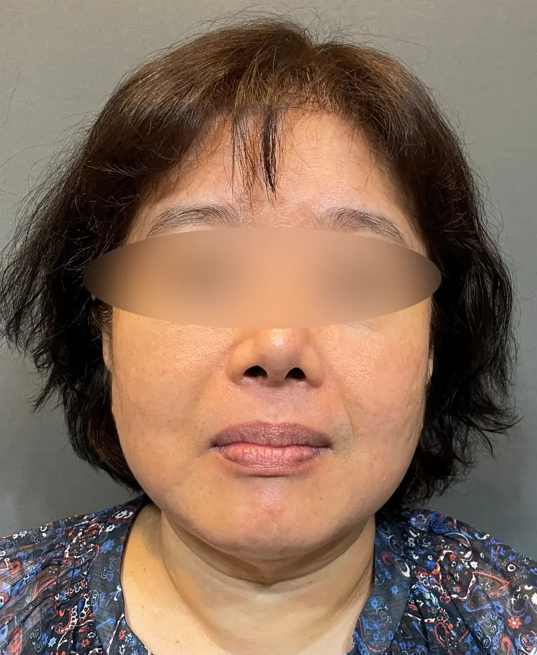 THE PLAN Plastic Surgery — 1