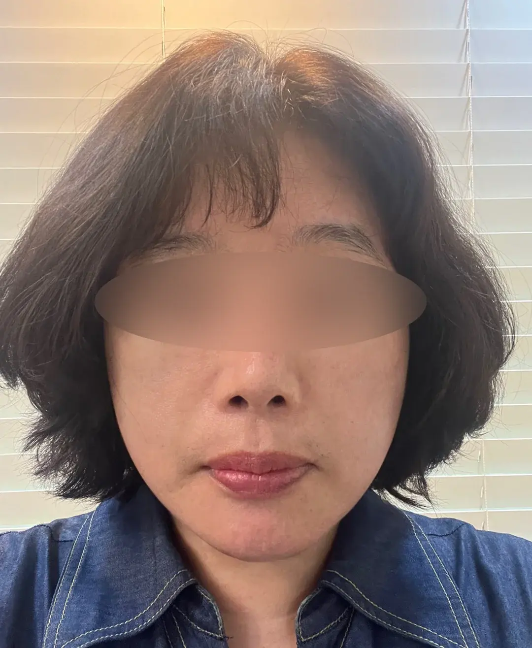THE PLAN Plastic Surgery — 2