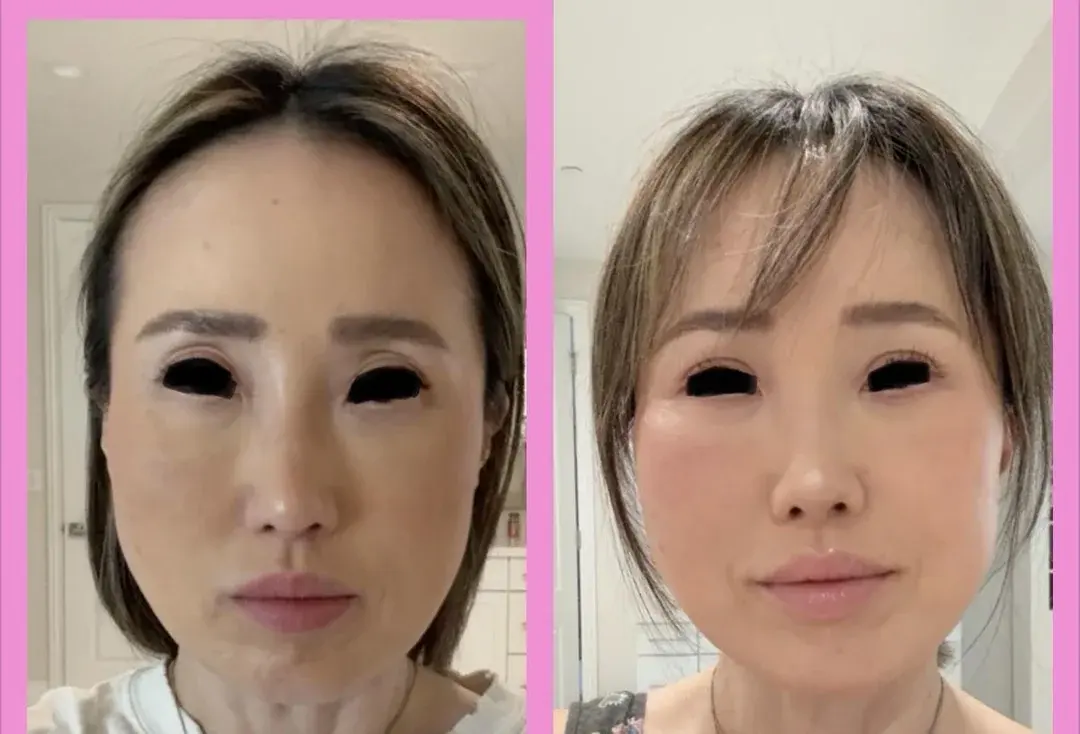 EYETING Plastic Surgery — 1