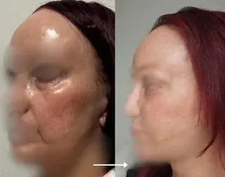 ARC Plastic Surgery — 1