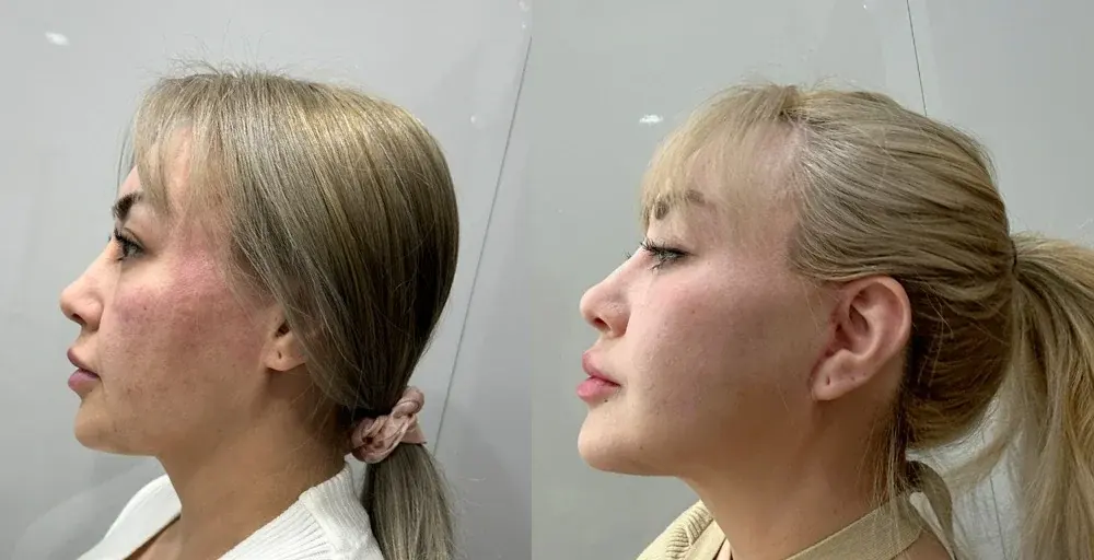 GIRIN Plastic Surgery Clinic — 1
