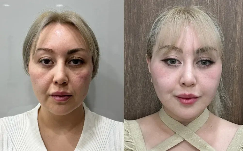 GIRIN Plastic Surgery Clinic — 2