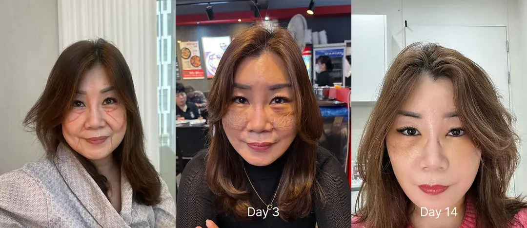ILCHI Plastic Surgery — 1