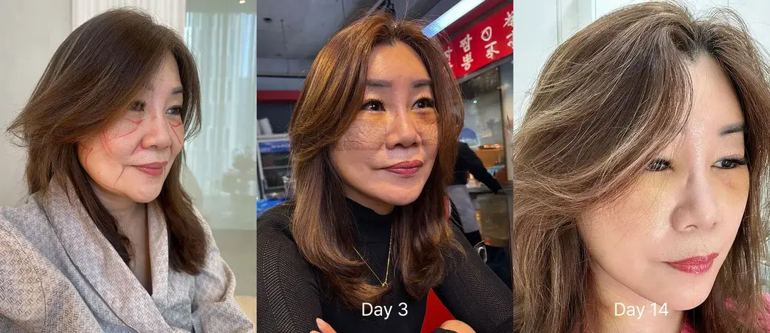 ILCHI Plastic Surgery — 2