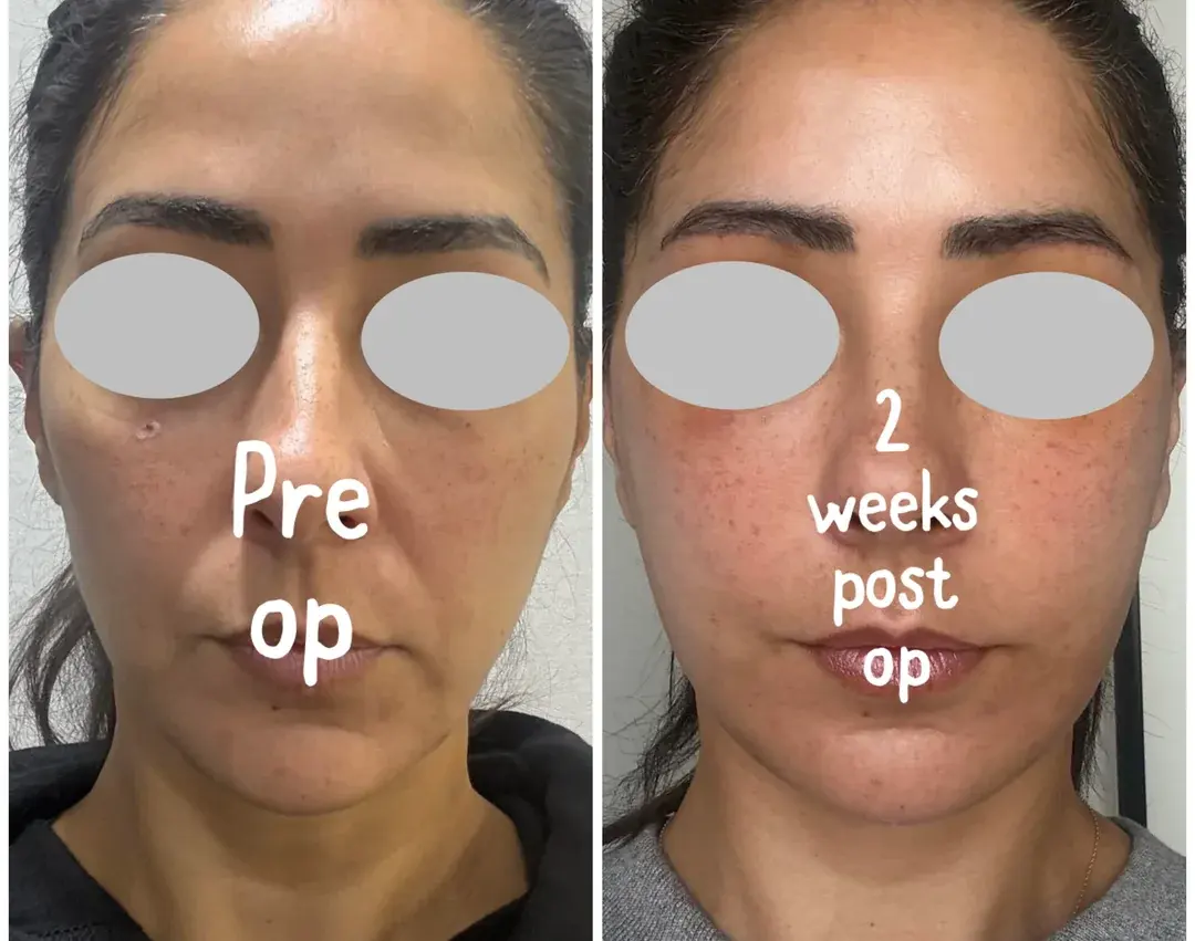 Dasipium Plastic Surgery — 1