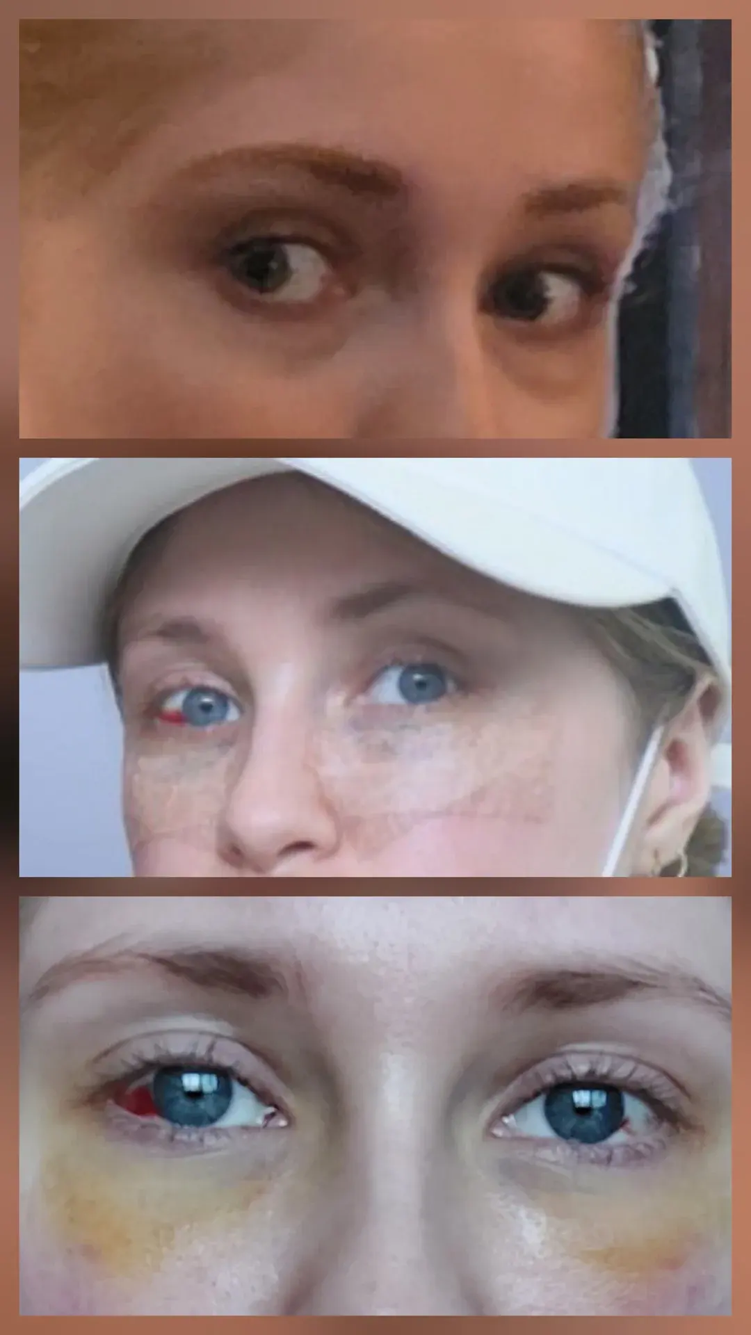 OBJET Plastic Surgery — 1