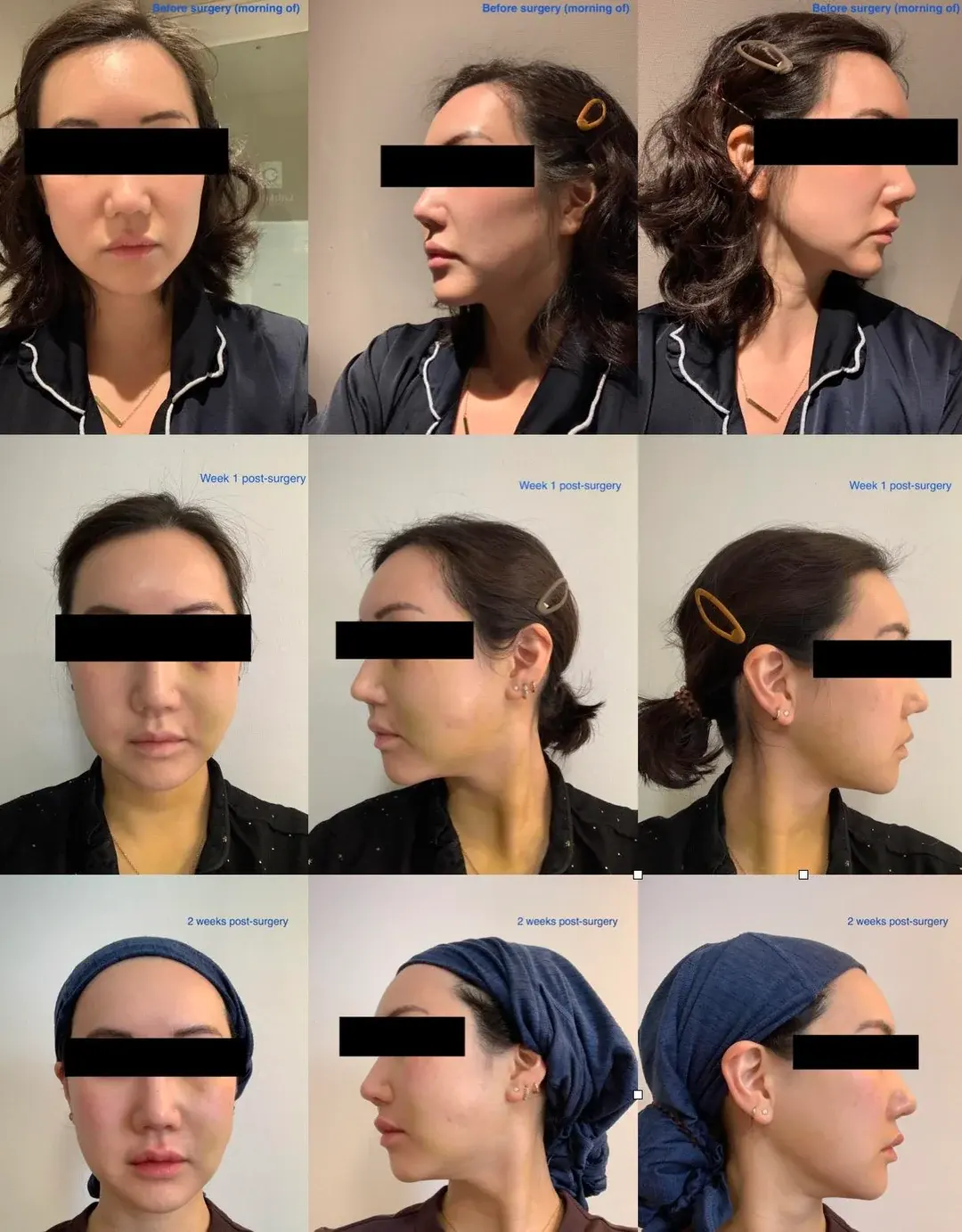 ONYOO Plastic Surgery — 1