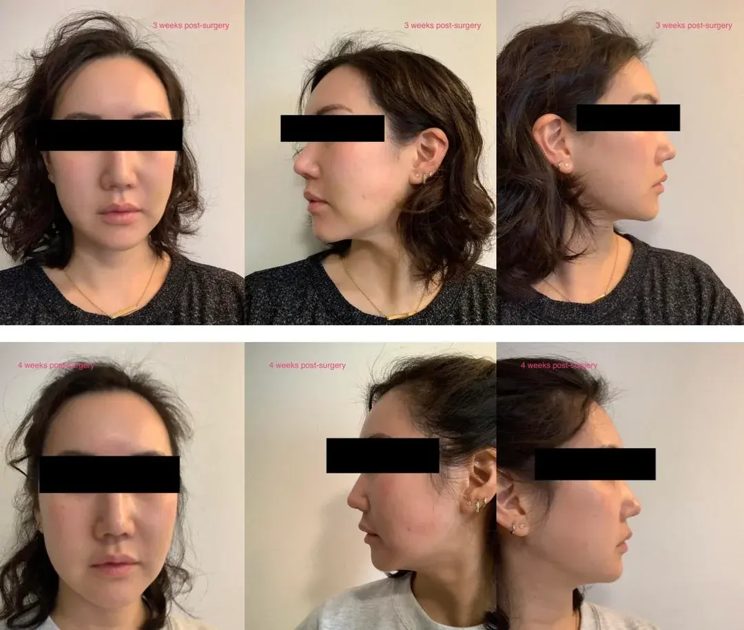 ONYOO Plastic Surgery — 2