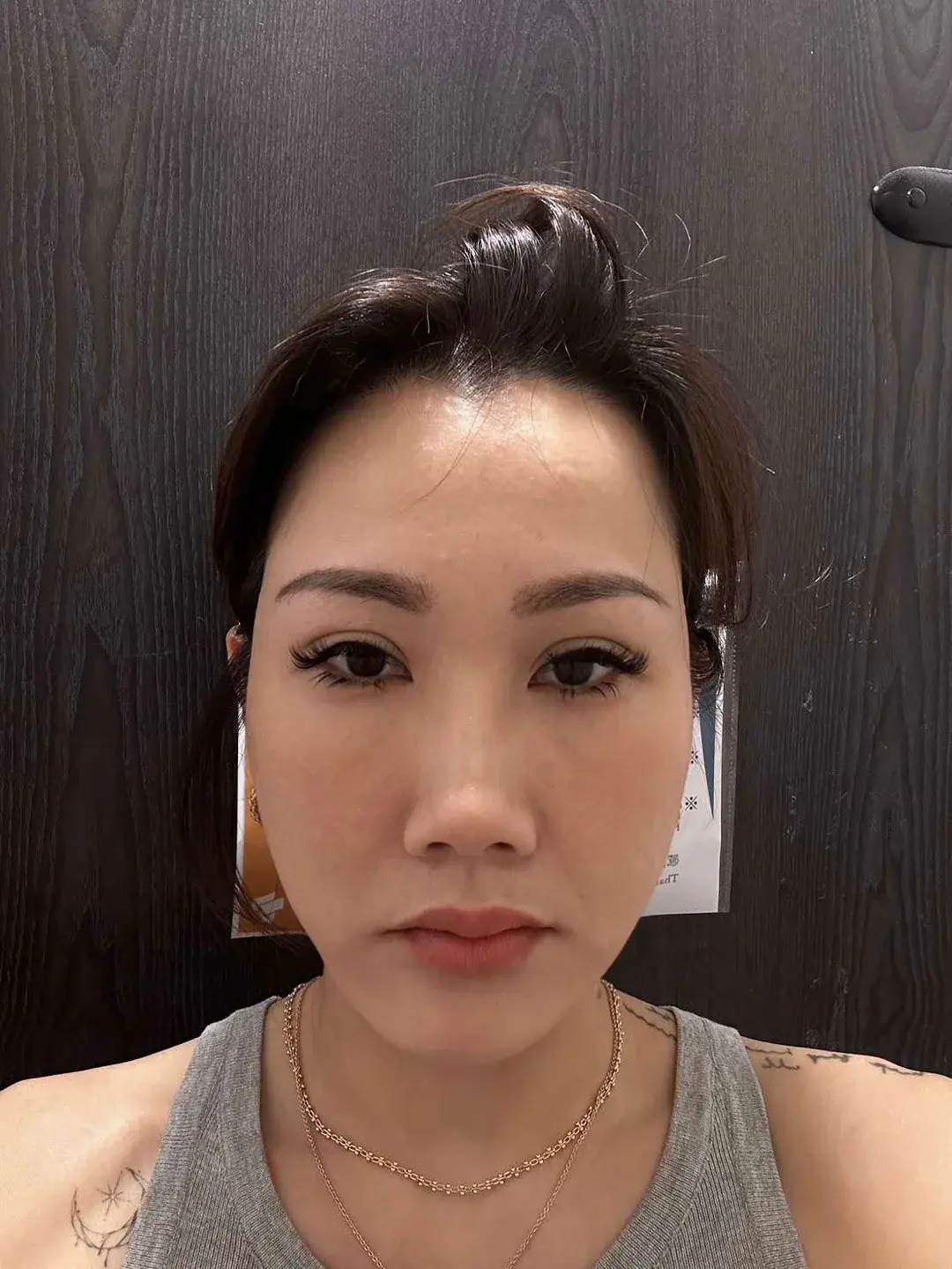 ILCHI Plastic Surgery — 1