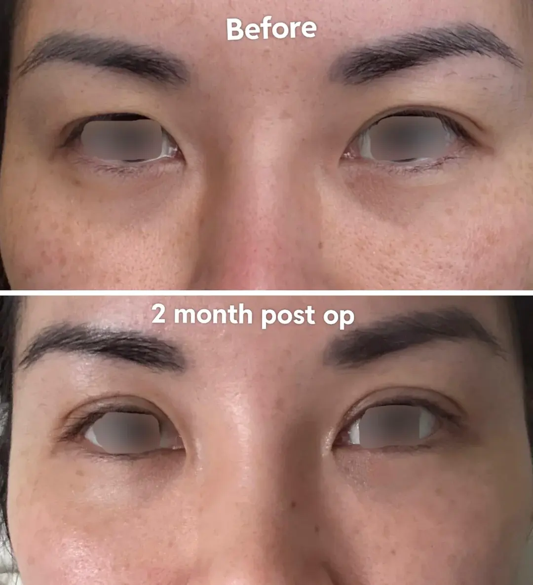 Woori Plastic Surgery Clinic — 1