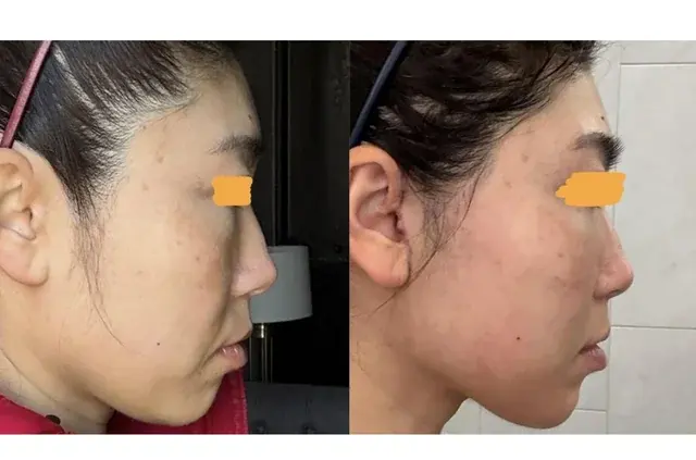 GIRIN Plastic Surgery Clinic — 1