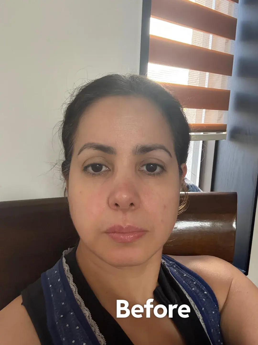 LIFF Plastic Surgery — 1