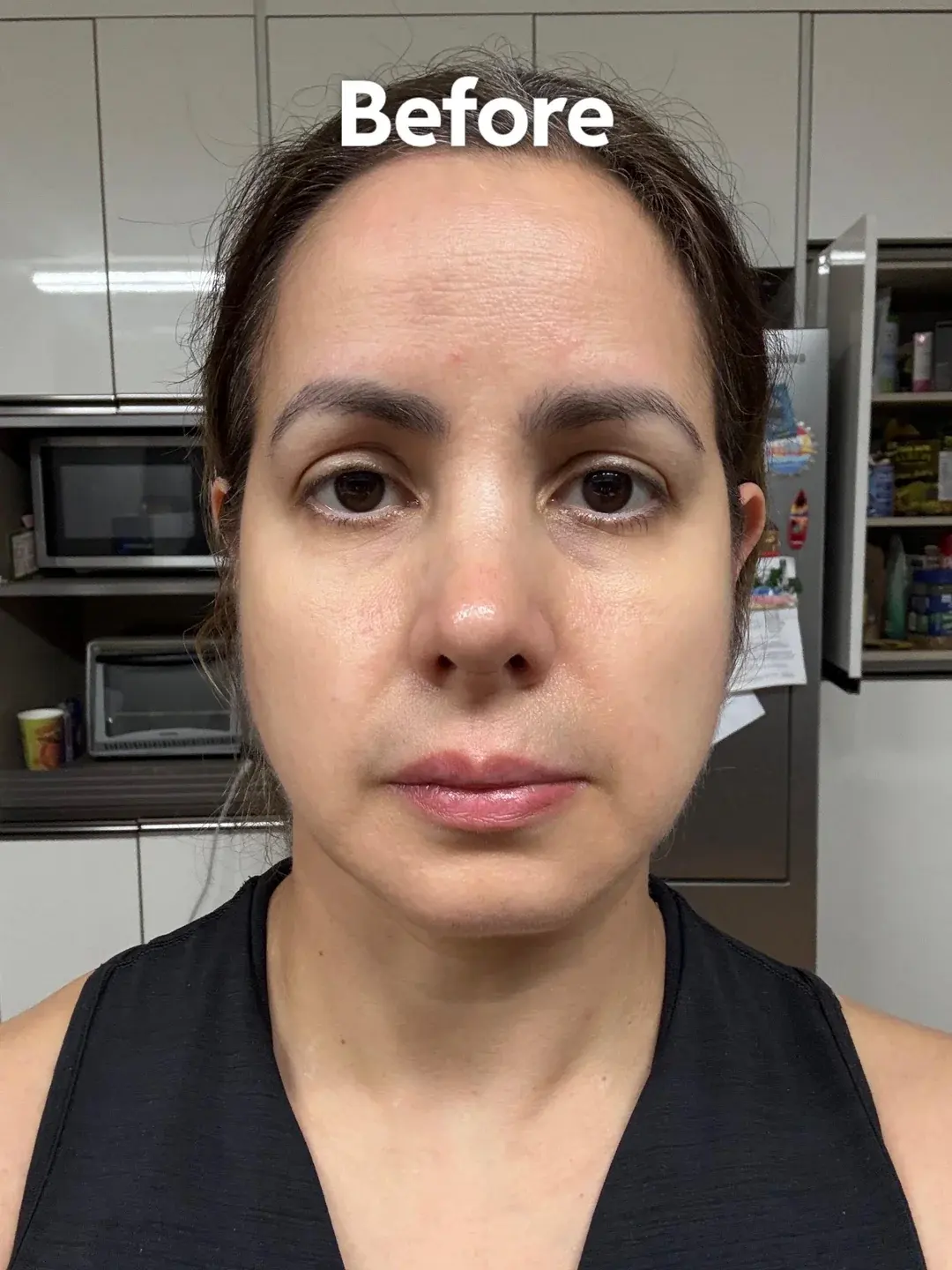 LIFF Plastic Surgery — 2