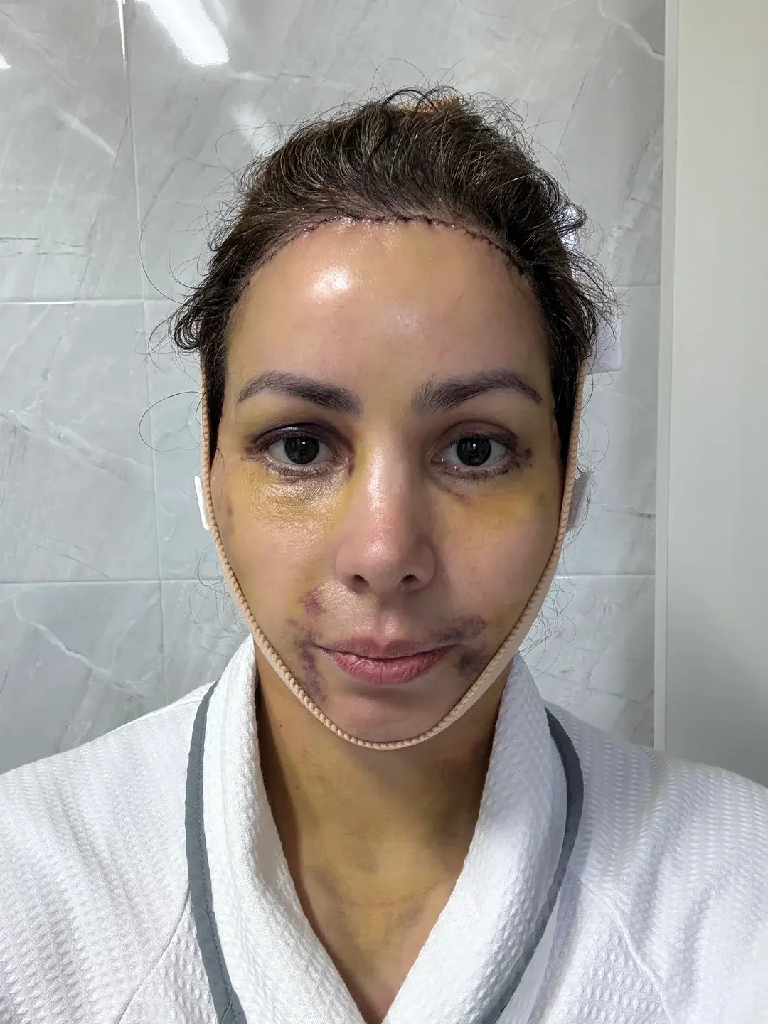 LIFF Plastic Surgery — 4