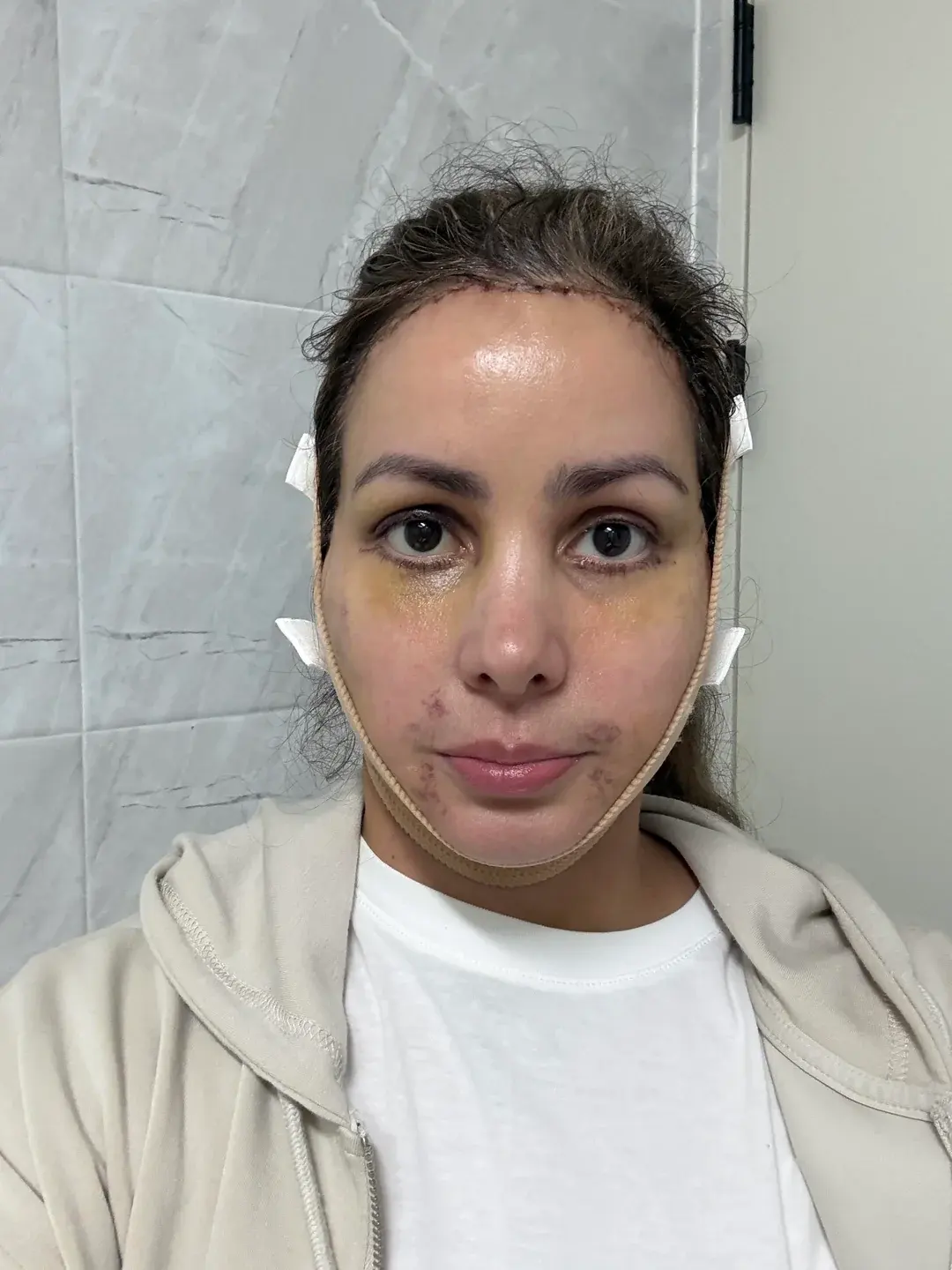 LIFF Plastic Surgery — 5