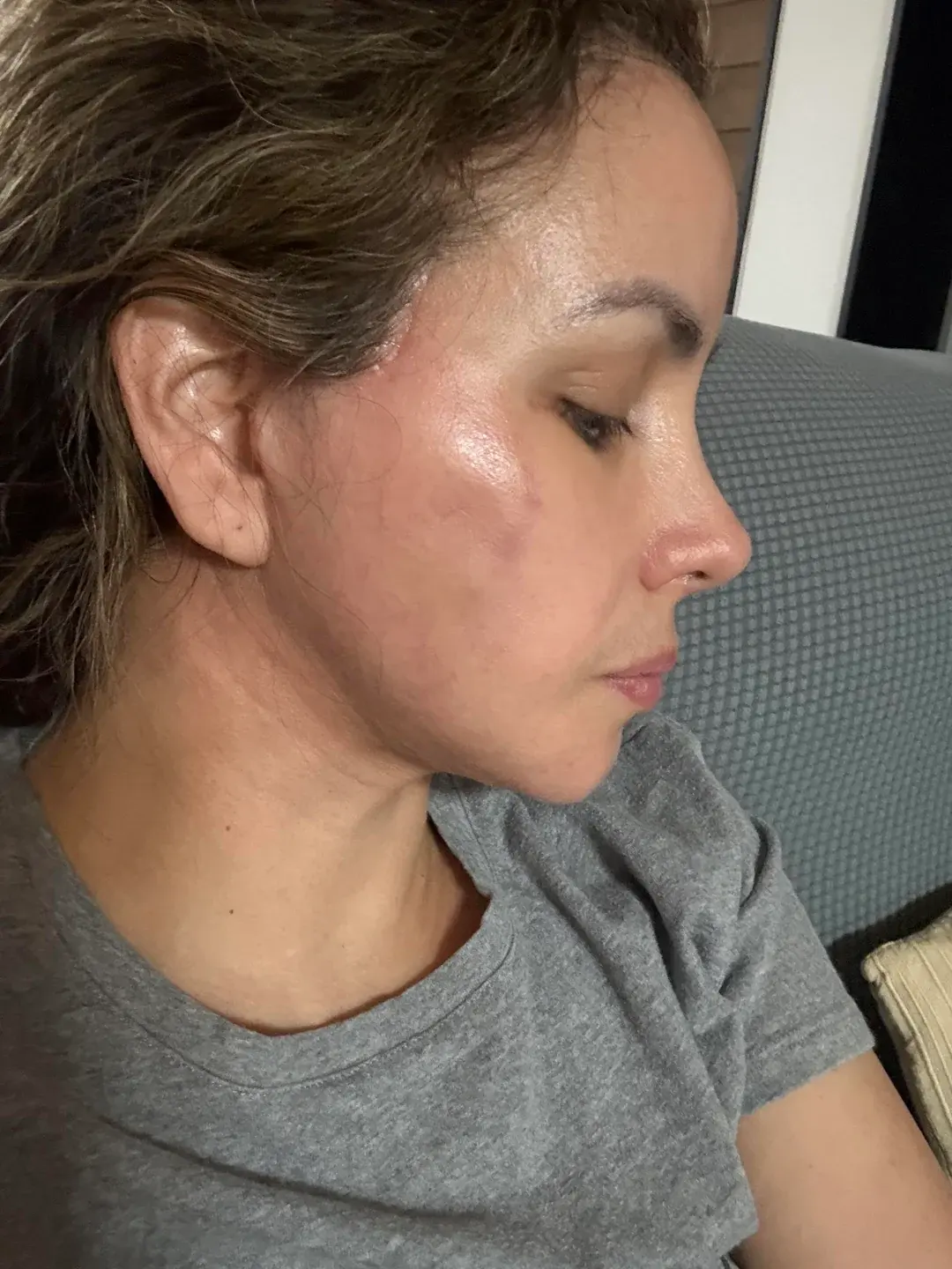 LIFF Plastic Surgery — 7