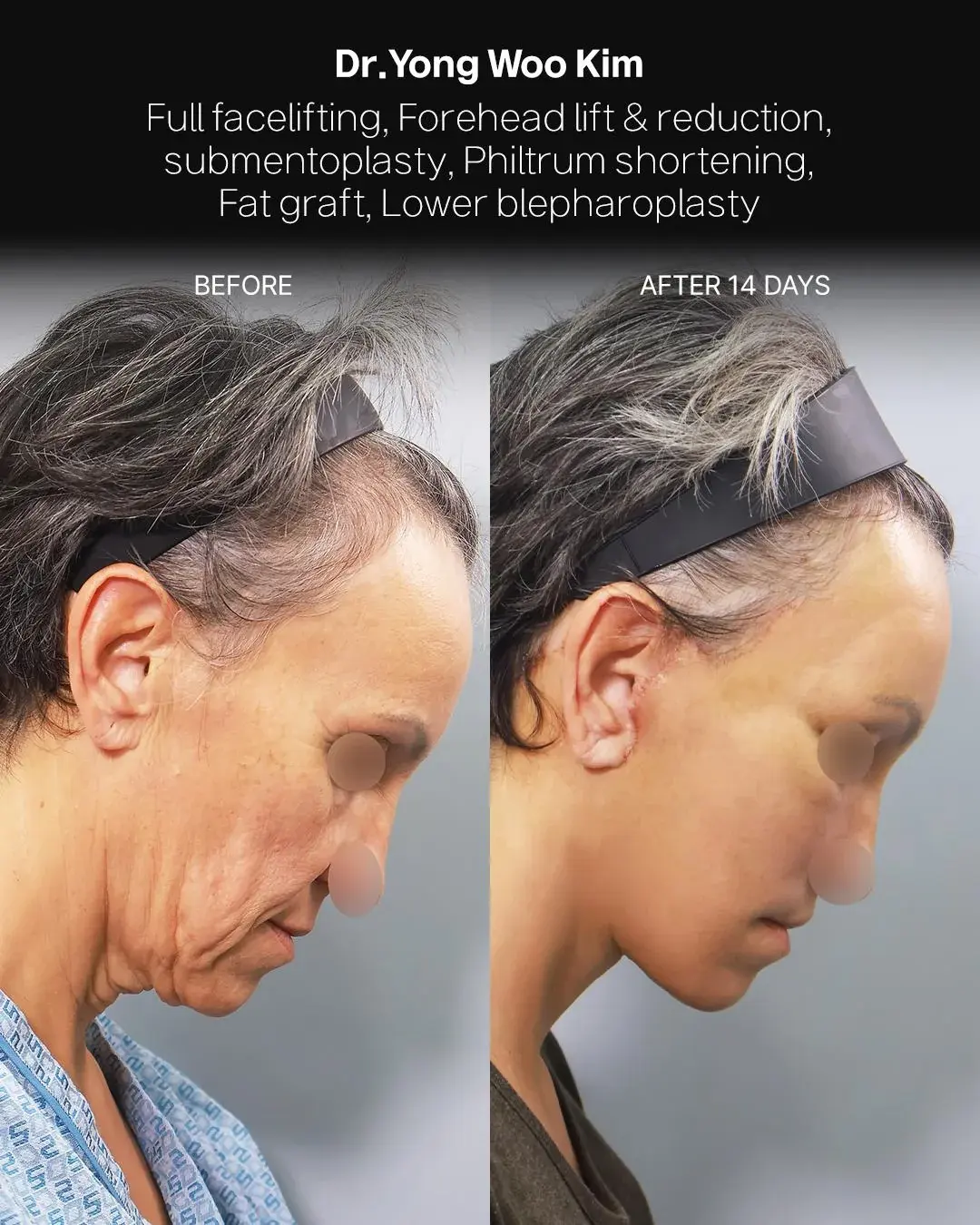 RETURNING Plastic Surgery — 3