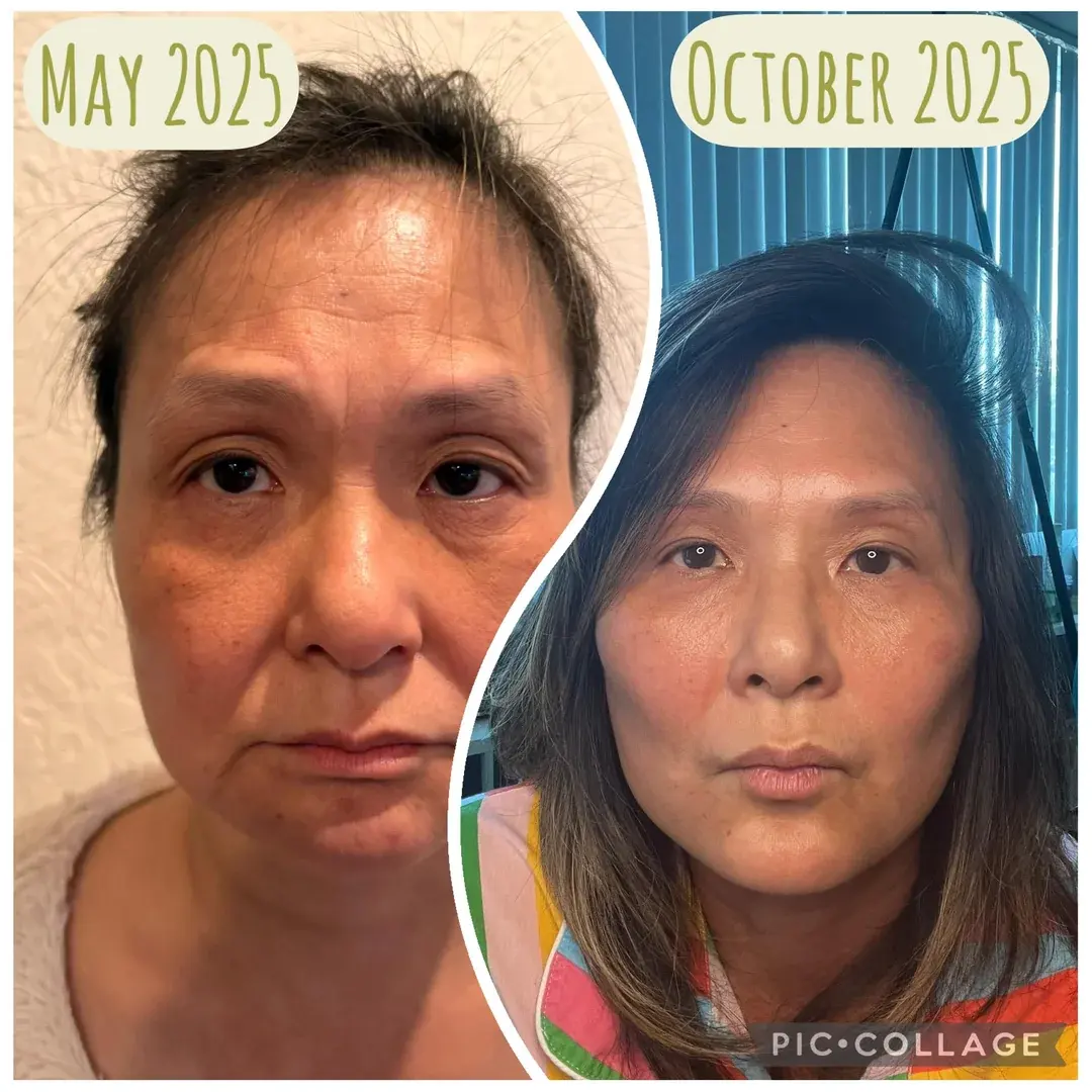 Marble Plastic Surgery — 1