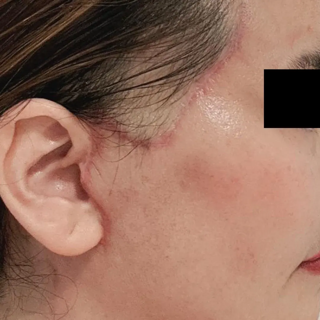 AB Plastic Surgery — 3