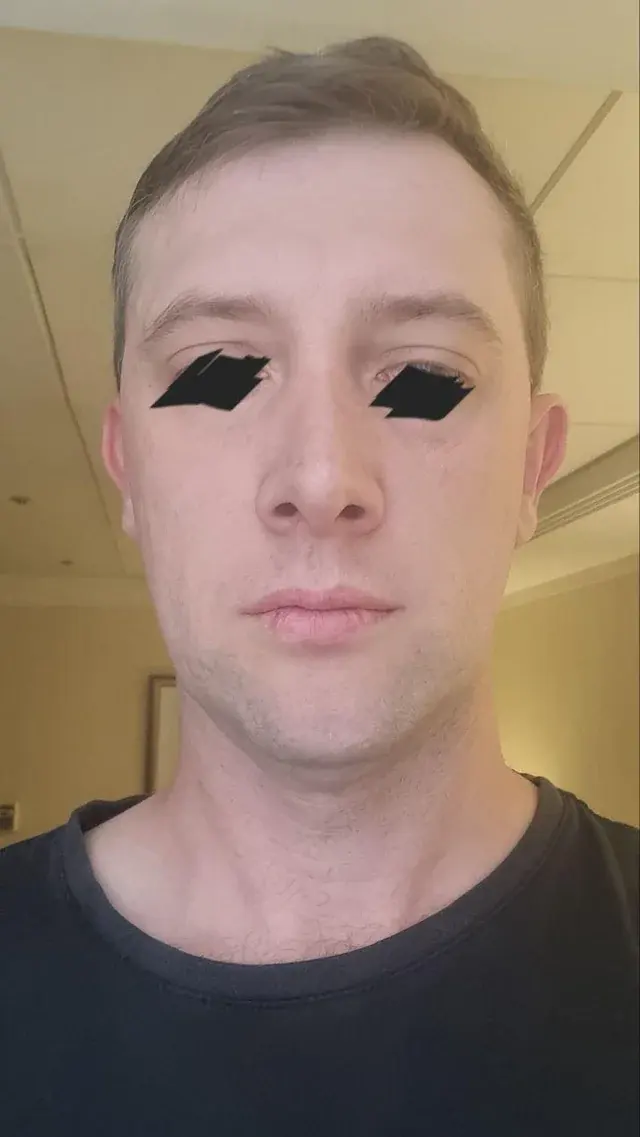 AB Plastic Surgery — 1