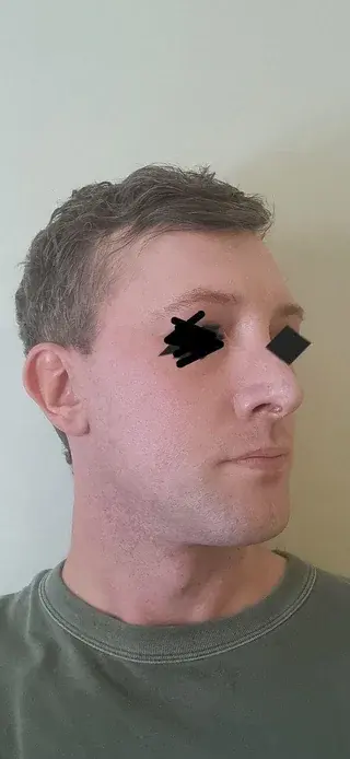 AB Plastic Surgery — 4