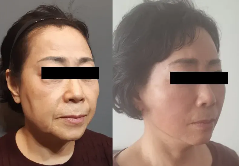 THE PLAN Plastic Surgery — 1