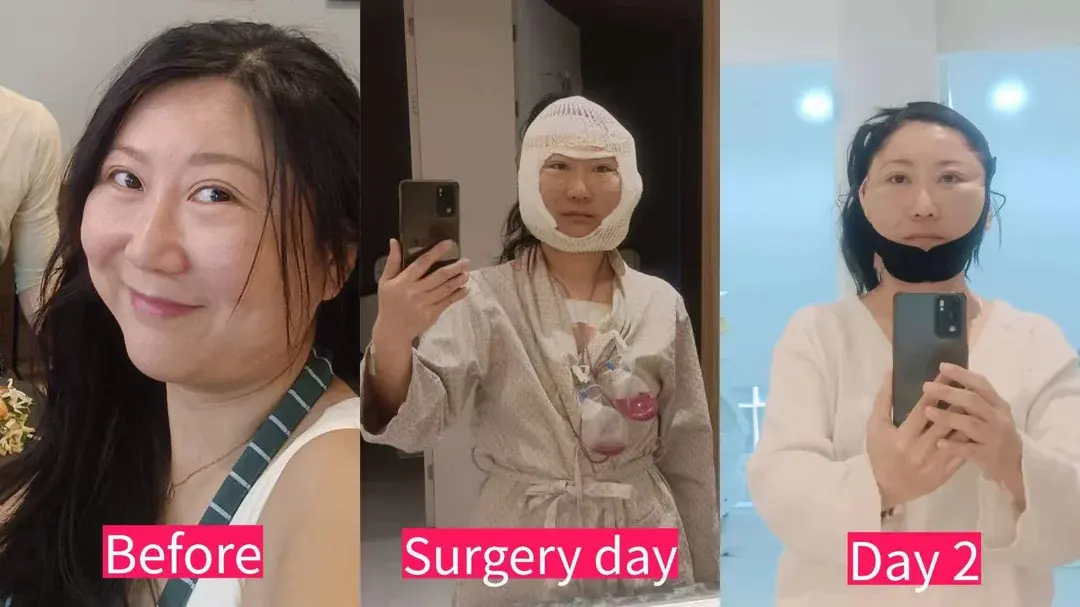 ILCHI Plastic Surgery — 1