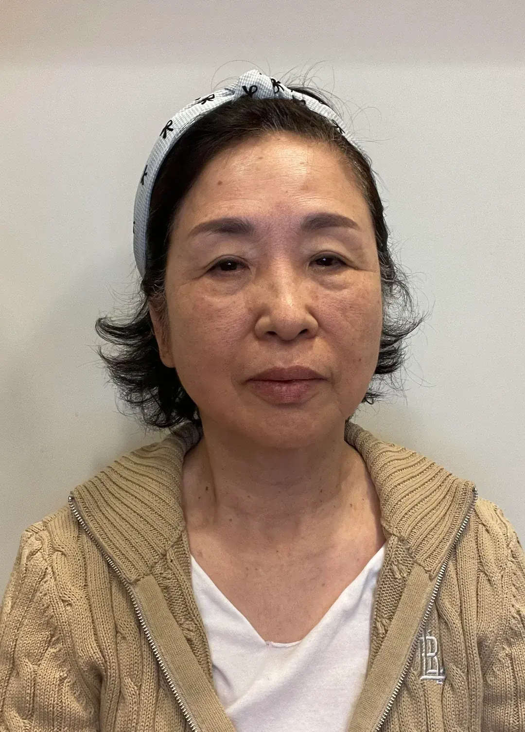 Apgujeong Seoul Plastic Surgery — 1